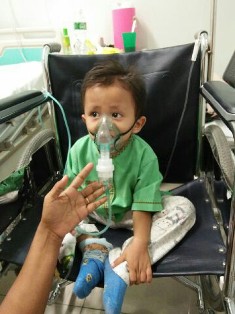 Akibat Kabut Asap, Balita di Kecamatan Tampan Terserang ISPA Hingga Sulit Bernafas
