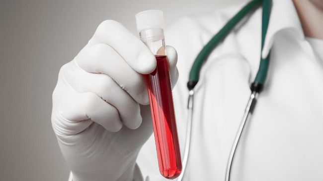 Studi Terbaru Temukan Obat HIV Efektif untuk Hidup Lebih Lama