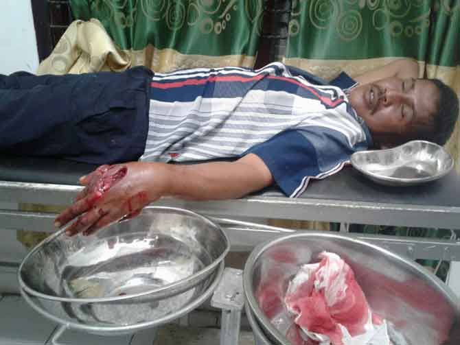 Siapkan Umpan, Nelayan Rantau Kopar Disergap Buaya 