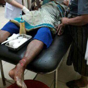 Merakit Kayu, Kaki Warga Rohil Diterkam Buaya 
