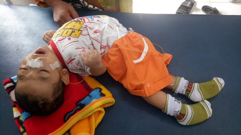 Anak Penderita Hidrospalus dan Meningitis di Siak Butuh Uluran Tangan