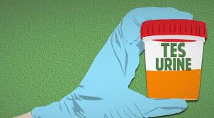Tes Urine untuk Melawan Narkoba