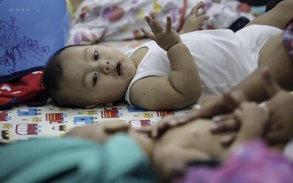 Deteksi Dini Gangguan Pendengaran pada Bayi 