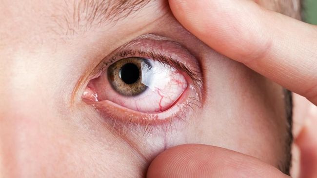 Terapi Laser, Cara Atasi Katarak Tanpa Bedah