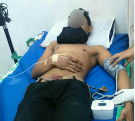 Polsek Kateman Buru Para Pelaku Pengeroyokan Dua Karyawan di Desa Air Tawar