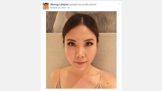 Jasad Miming akan Diautopsi Pekan Depan di Sydney