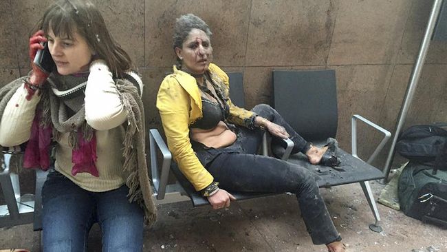 Korban Bom Brussels, Kehilangan Kaki dan Baut di Rongga Dada