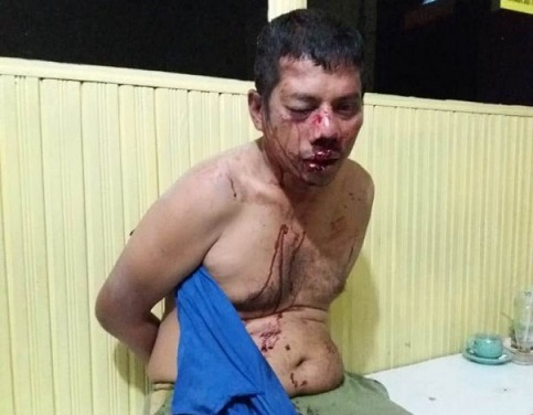 Draiver Ojol di Pekanbaru Dirampok Penumpang