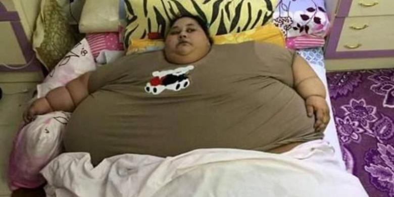 Berbobot 500 Kg, Perempuan Ini Hanya Bisa Terbaring di Tempat Tidur 