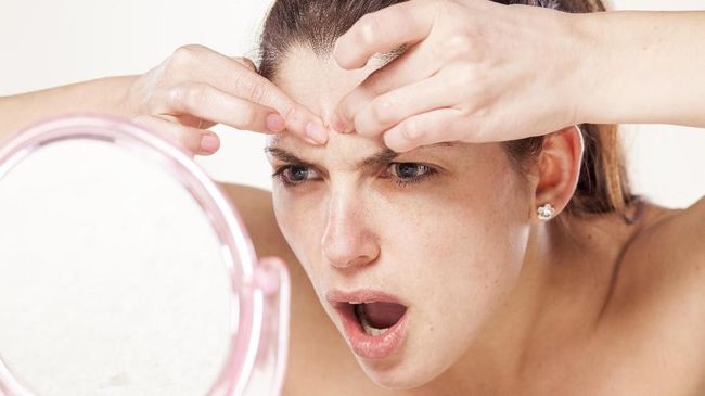 Fakta di Balik Menstruasi Bikin Jerawatan