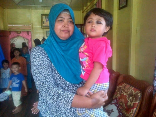 Mata Balita Cantik Ini Bengkak dan Berdarah, Juga Sesak Nafas, Batuk dan Muntah-muntah