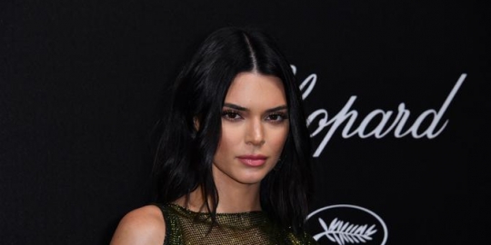 Gara-Gara Jerawat, Kendall Jenner Menangis Berhari-hari