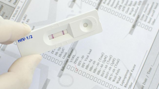 Batam Rentan Penularan HIV/AIDS