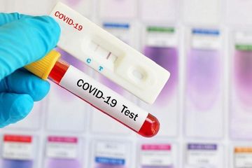 Pekanbaru mulai rapid test warga di zona merah Tampan 