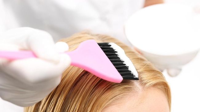 Wanita Inggris Alami Luka Bakar Parah Akibat Bleaching Rambut