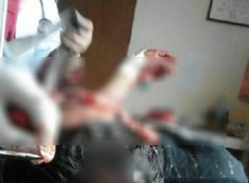 Aneh, Sempat Ngobrol dan Minum Air Kelapa Muda, 2 OTK Bacok  Pedagang , Kini Pelaku Diburu Polisi