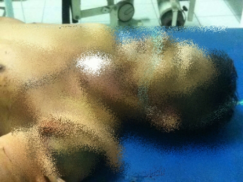 Baru Pulang Kampung, Bahar Pane Dibacok 5 Kali, Pelaku Diburu Polisi