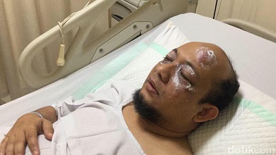 Penyidik Senior KPK Novel Baswedan Disiram Air Keras oleh OTK