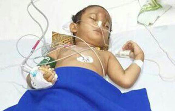 Bocah Penderita Kista Asal Inhil Dirujuk ke RSUD AA Pekanbaru