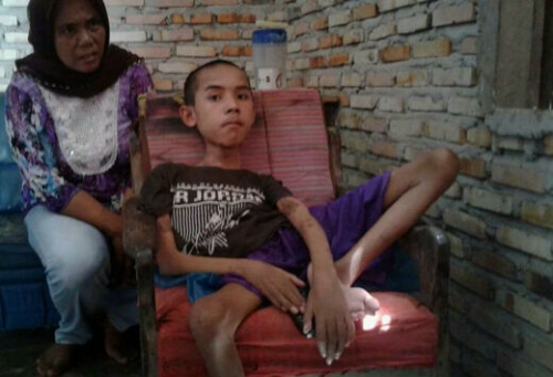 Sudah 8 Tahun Lumpuh Total, Anjala Zikri Warga Pinggir Ini Butuh Uluran Tangan Dermawan