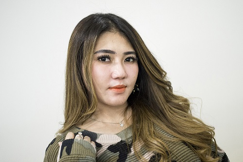 Via Vallen Pilih Perawatan Agar Pipi Tirus 