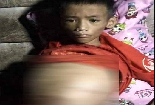 Menderita Tumor Ganas di Perut, Riski Aril Butuh Uluran Tangan Dermawan