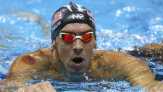 Ketika Bekam Populer di Olimpiade Rio de Janeiro