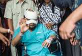Polda Metro Buka Peluang Menjerat Novel Baswedan