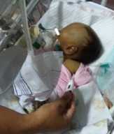 Bayi Penderita Gastroschisis Asal Inhil Meninggal di RSUD Arifin Achmad Pekanbaru