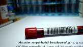 Mengenal Kanker Darah: Leukemia