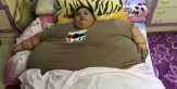 Berbobot 500 Kg, Perempuan Ini Hanya Bisa Terbaring di Tempat Tidur