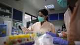CDC Konfirmasi Hubungan Zika dan Mikrosefalus