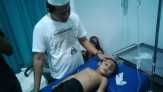 Bocah Penderita Tumor di Inhil Butuh Donatur