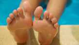 Mengenal Bunion pada Tulang Jempol Kaki dan Cara Mengatasinya